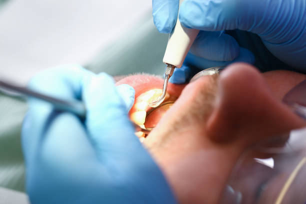 Reliable CA Emergency Dental Service Solutions